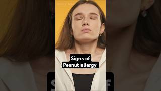 Signs of Peanut Allergy #Health #Science #Food