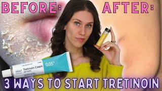 3 Ways To Start Tretinoin Without Irritation - How To Start Retinoids Without Irritation \u0026 Peeling