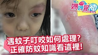 蚊子叮險變蜂窩性組織炎 正確防蚊教你如何解決？！ 媽媽好神 20180301 part1/4 EP201 丁寧 陳保仁