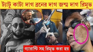 মেছতা/কাটাদাগ/আঁচিল/অবাঞ্চিত লোম এর লেজার চিকিৎসা 🔥ট্যাটু রিমুভ laser treatment in bangladesh 2025