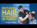 Afro Hair Transplant in Turkey - DR ARSLAN Musbeh - Hairmedico