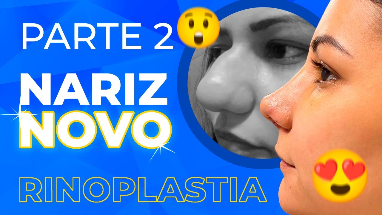 PÓS-CIRÚRGICO 👃🏻 RINOPLASTIA - EP2 - YouTube