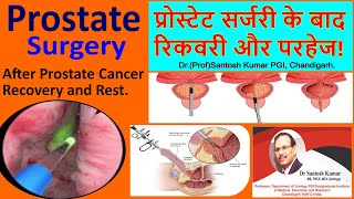 प्रोस्टेट surgery के बाद सामान्य निर्देश हैं।Prostate surgery and precaution .Dr.Santosh Kumar PGI.
