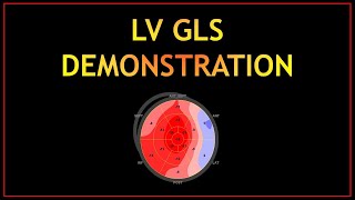 GLS Practical Demonstration! (PART 2)