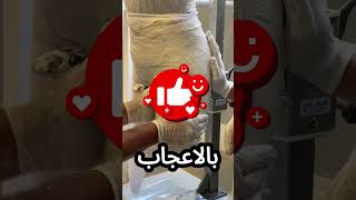 هذه الفتاة عادت للمشي على قدميها بفضل هذا الطبيب! 😢