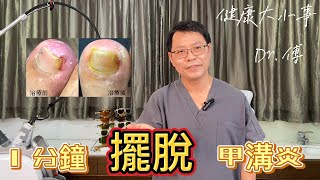 1分鐘擺脫甲溝炎