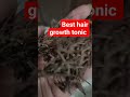 world s best hair growth tonic for india hair hair hairgrowth hairgrowthtips shorts short