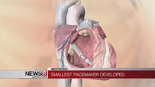 World's smallest pacemaker developed