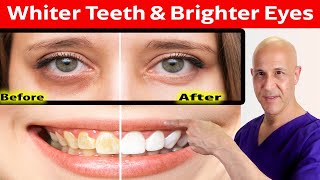 The Magic Minerals for Whiter Teeth and Brighter Eyes:  Banish Stains and Dark C
