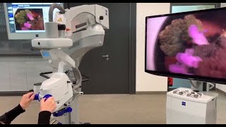 ZEISS ARTEVO 800 -  Anterior segment application: Visualization with DigitalOptics