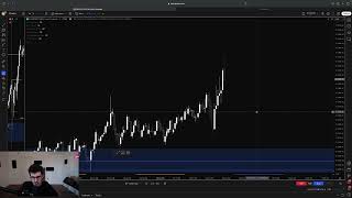 How I Made $9,092 Day Trading NQ Futures (FOREVER MODEL)