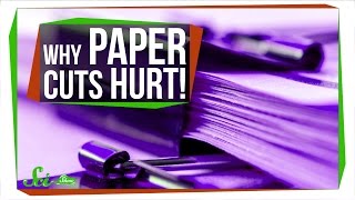 Why Are Paper Cuts So Painful?