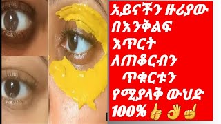 # የአይናችን ዙሪያው ለጠቆርብን  አሪፍ መፍትሔ እና ማስለቀቂያ