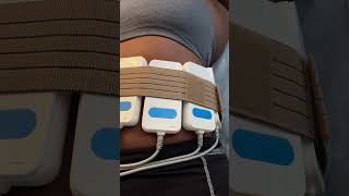 Laser Lipo Machine | Bodysculpting | Body Contouring #bodysculpting #bodycontouring #laserlipo