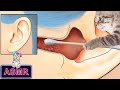 [ASMR] Cool and amazing ear cleaning animation 2