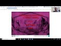 How To Build Unity WebGL and Host It