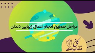 مراحل صحیح انجام عمل زیبایی دندان