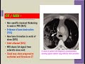 granulomatous diseases of nose dr krishna koirala dr. krishna s ent lectures