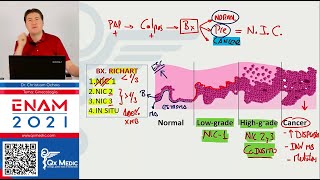 TEORIA III - GINECOLOGÍA