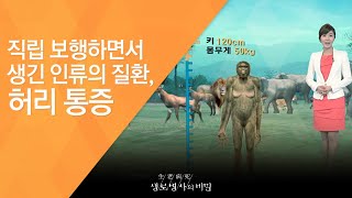 직립 보행하면서 생긴 인류의 질환, 허리 통증 - (2011.4.2_367회 방송)_내 몸의 기둥, 척추