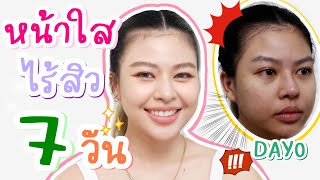 อยากหน้าใสไร้สิวทำได้ง่ายๆ ใน 7 วัน!! | MAYNESSA