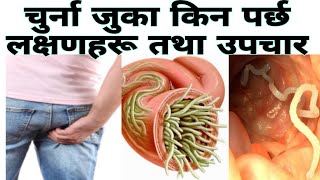 Pin worm infection|In Nepali चुर्ना कसरी पर्छ|यसका कारण लक्षणहरू र उपचार सम्पूर्ण जानकारी |