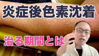 アトピーの炎症後色素沈着の良くなる期間と方法