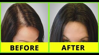 Hair Growth Tips In Tamil Fastest Hair Growth Tips Easy Hair