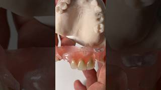 This is a FiberFlex Partial that we just completed in my lab for Dr. Michael Neglia in Illinois
