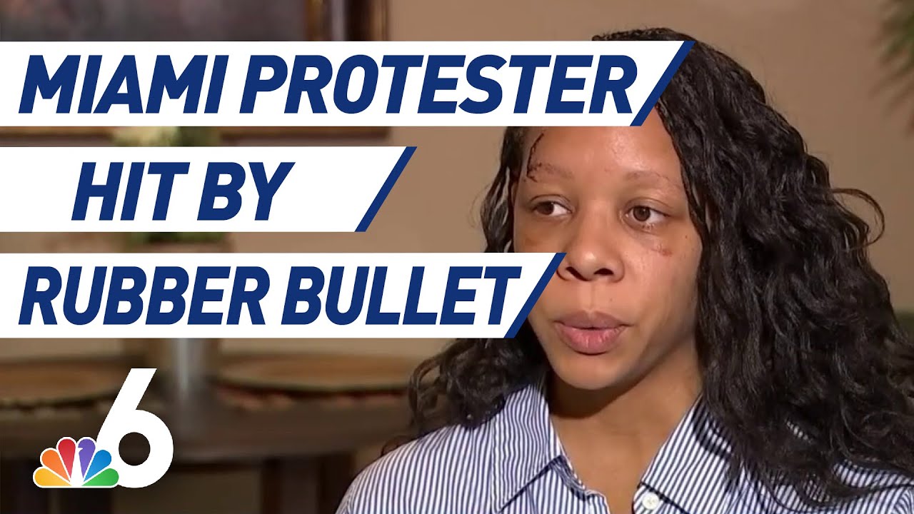 Woman Struck By Rubber Bullet During Protest Hopes For Change - YouTube