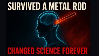 He Survived a Metal Rod Through His Brain – And Changed Science Forever
