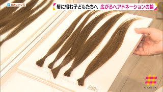 広がるヘアドネーションの輪　髪に悩む子供たちへ