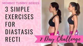Get Rid Of Mommy Tummy with 3 Simple Diastasis Recti Exercises  | 7 Day Challenge