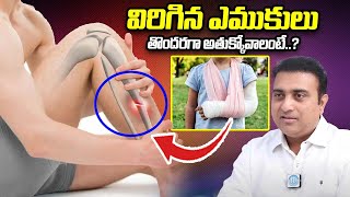 విరిగిన ఎముక అతుక్కోవాలంటే || Bone Fracture Recovery Tips By Dr Koteswara Prasad || iDream Health