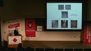 CALS Discoveries Seminar. Molecular Pathogenesis of Blastomyces. Greg Gauthier. 2018.03.22