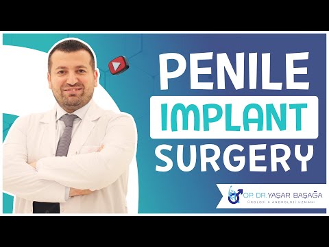 Penile Implants Surgery - Dr. Yaşar Başağa, MD, FEBU - YouTube