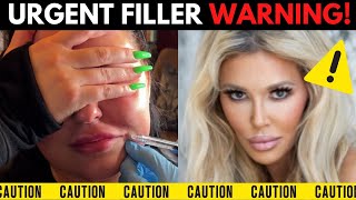 Are Fillers Ruining Your Face? Plastic Surgeon's Urgent Warning!