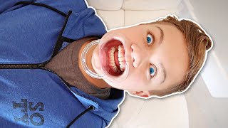 Stephen Gets BRACES!