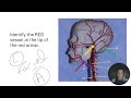 AP II Practice Lab Practical Blood Vessels