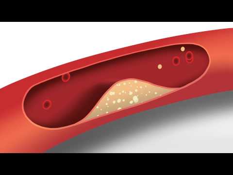 What are the 5 factors that affect blood pressure?