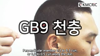 GB9 천충 天衝 Tianchong (Eng sub) - KMCRIC WHO Standard acupoint DB