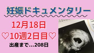 【妊娠ドキュメンタリー】出産まで残り208日