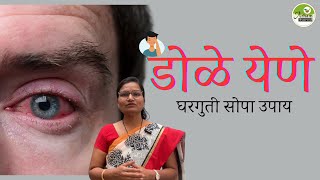 डोळे येणे | घरगुती सोपा उपाय | Eye Flu| Conjunctivities| Dr. Smita Bora