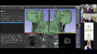 ZOOM meeting - Making an Implant Guide from start to finish