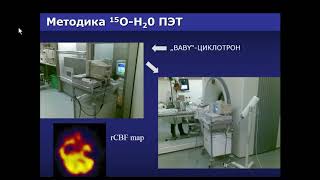 Сухов В.Ю. «Неинвазивная молекулярная визуализация ишемии и гипоксии головного мозга»