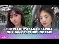 Jadi Bahan Bullying, Permesta Dhyaz Anak Farida Nurhan Lakukan Operasi Plastik