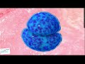 განაყოფიერების პროცესი the process of fertilization medcast