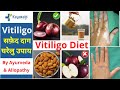 Vitiligo Diet & Home Remedies| सफेद दाग में क्या खाएं क्या न खाए| सफेद दाग के घरेलू उपचार | Kayakalp