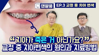 [덴탈룸] 교정 중 치아 변색, 치아가 죽은 거 아닌가요?