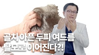 두피에 나는 여드름을 방치하면 안되는 이유!!_[모발이식, 탈모 해결사]